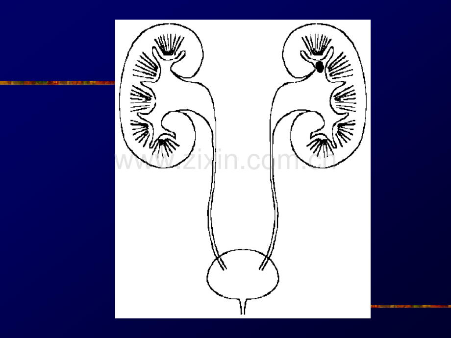 小儿血尿的鉴别诊断.pptx_第2页