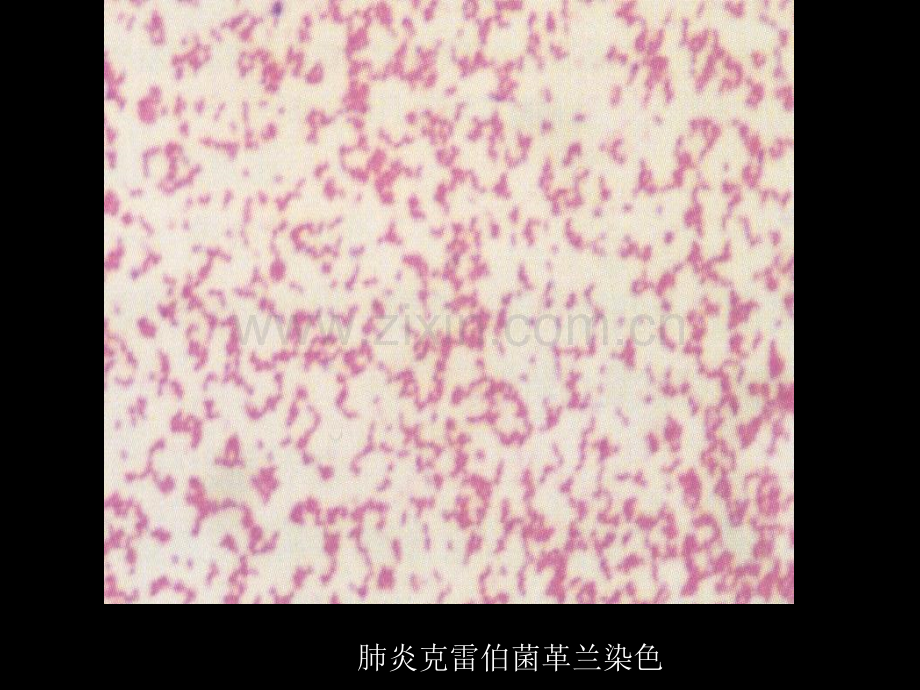 微生物学检验第3版2012肺炎克雷伯与痰液标本检查.pptx_第2页