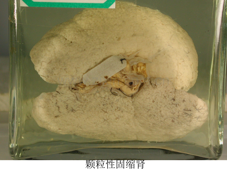 泌尿系统疾病1.pptx_第1页