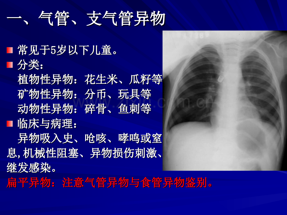 呼吸系统常见疾病影像诊断.pptx_第2页