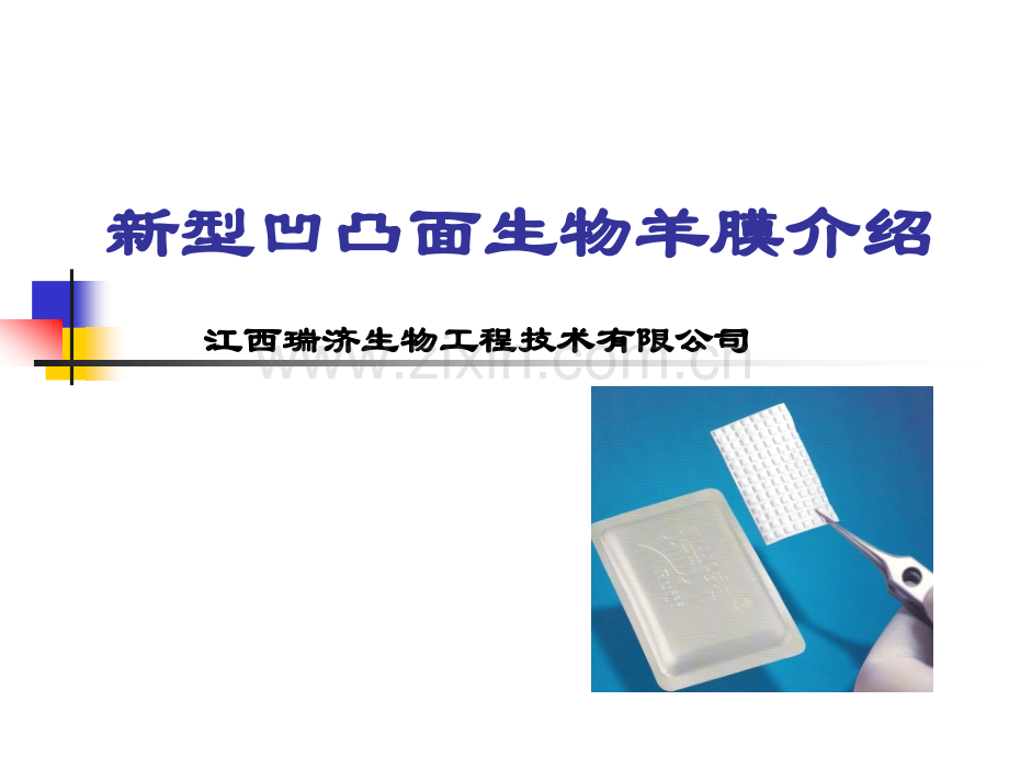 新型凹凸面生物羊膜介绍.pptx_第1页