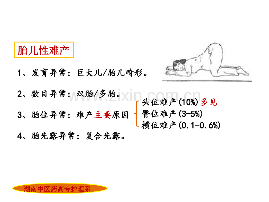 宫缩乏力湖南中医药高等专科学校护理系.pptx_第2页