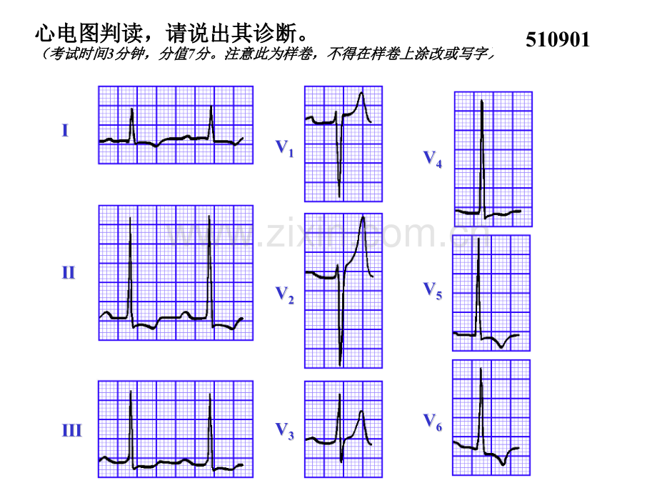 心电图判读.pptx_第1页