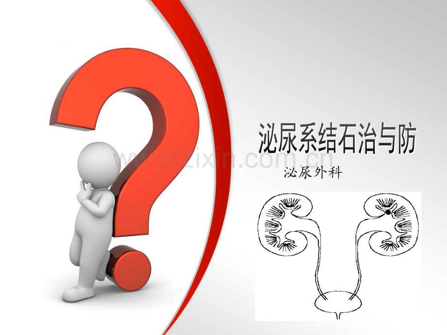 泌尿系结石健康教育.pptx_第1页