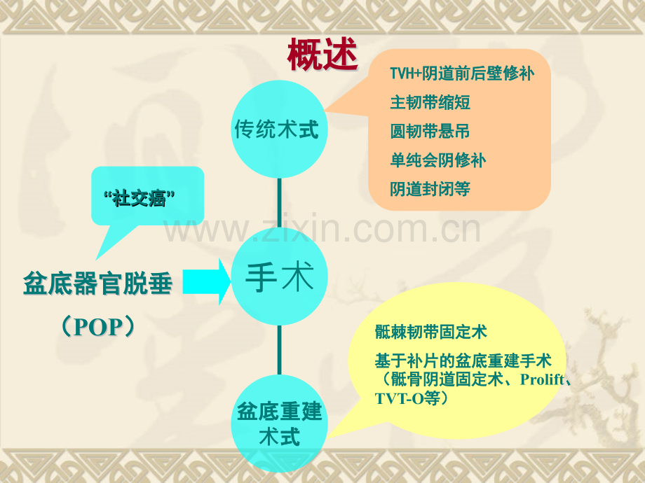 利用自身组织治疗POP.pptx_第2页
