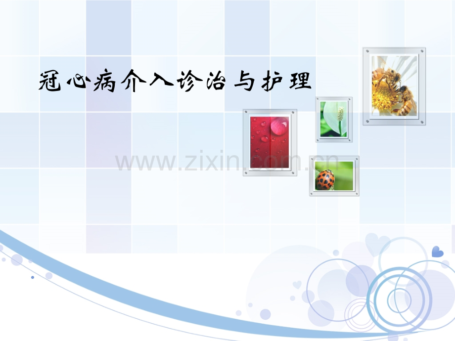 冠脉介入治疗与护理.pptx_第1页