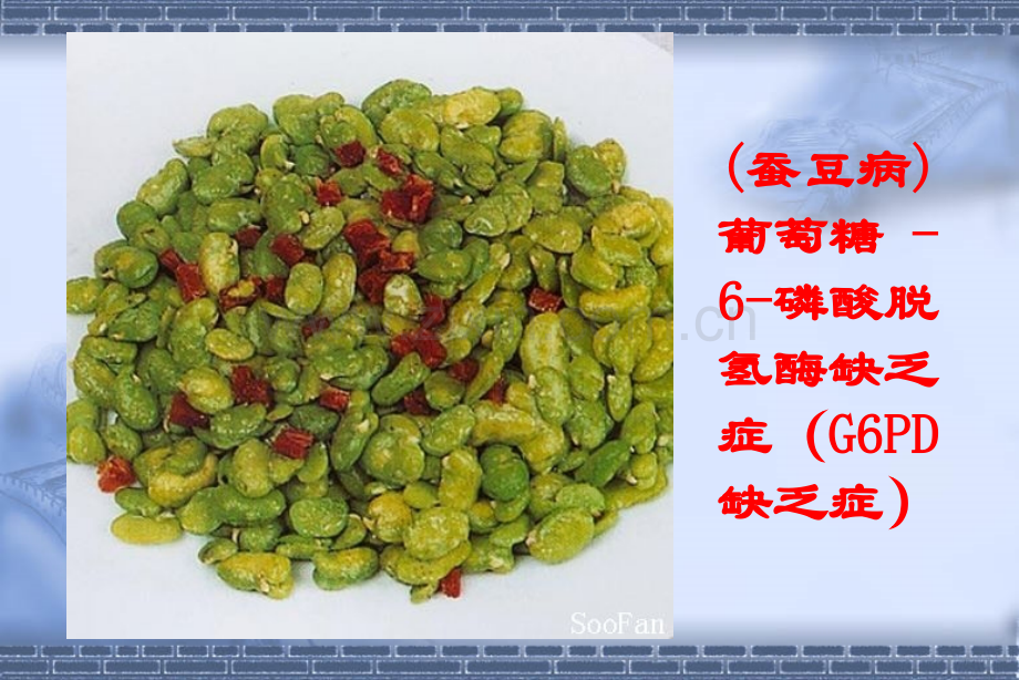 完美医学之溶血性疾病.pptx_第2页