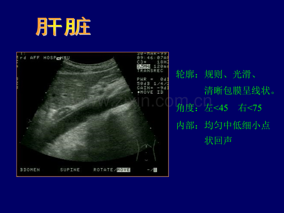 常见病B超.pptx_第1页