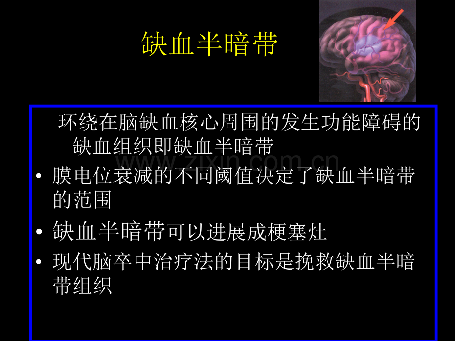 卒中的进展ppt.pptx_第1页