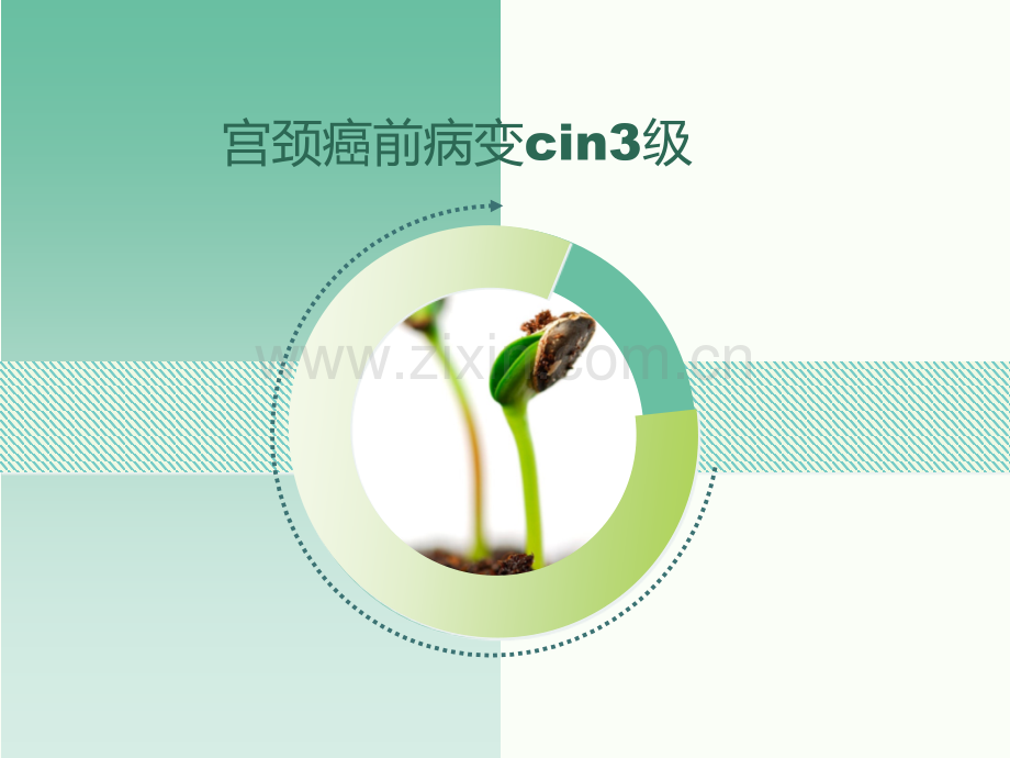 宫颈癌前病变cin3级.pptx_第1页