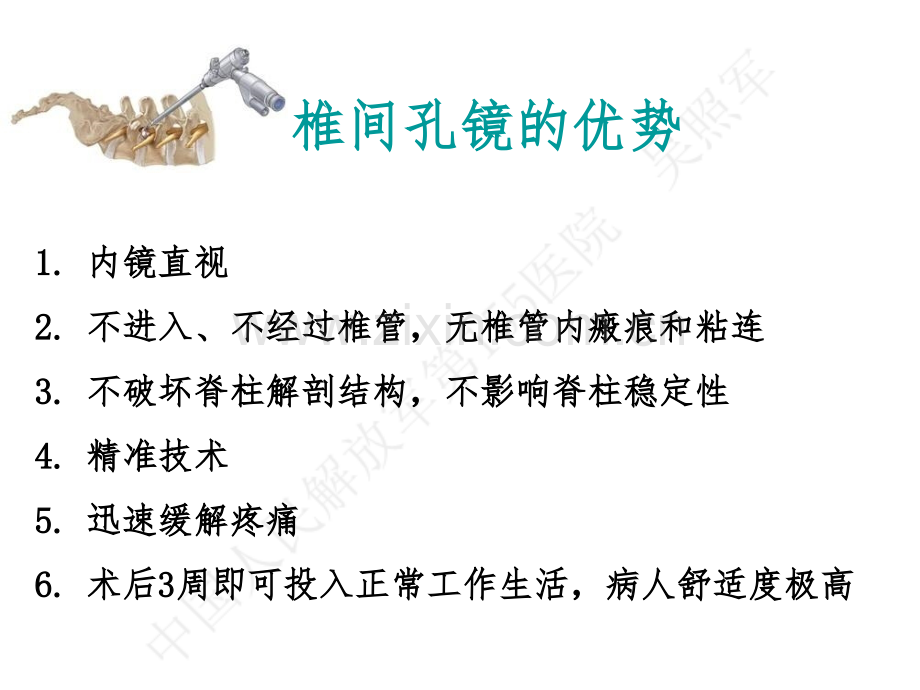 吴主任椎间孔镜课件.pptx_第2页