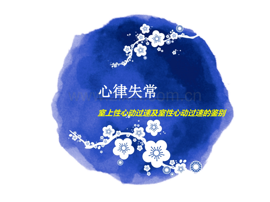 心律失常室速和室上速的鉴别.pptx_第1页