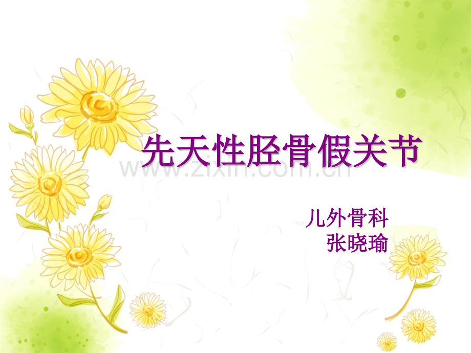 先天性胫骨假关节概要.pptx_第1页