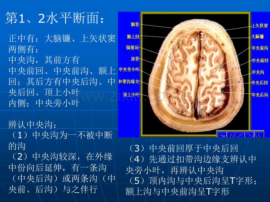 2头部断面.pptx_第2页
