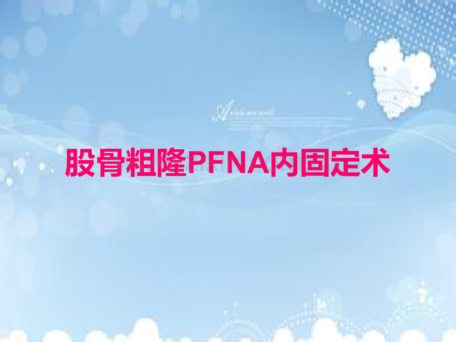 PFNA内固定术.pptx_第1页