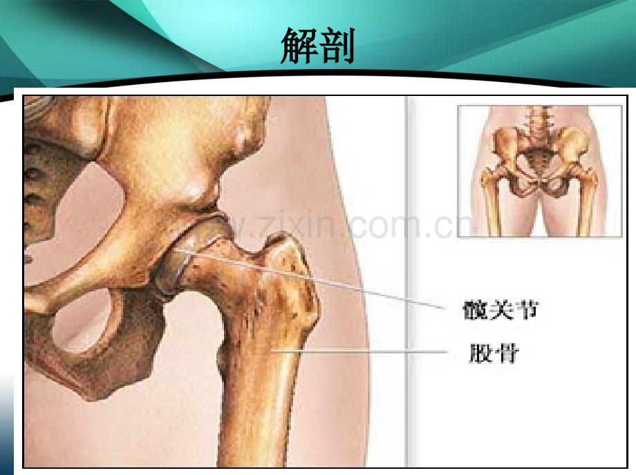 全髋置换健康讲座.pptx_第2页