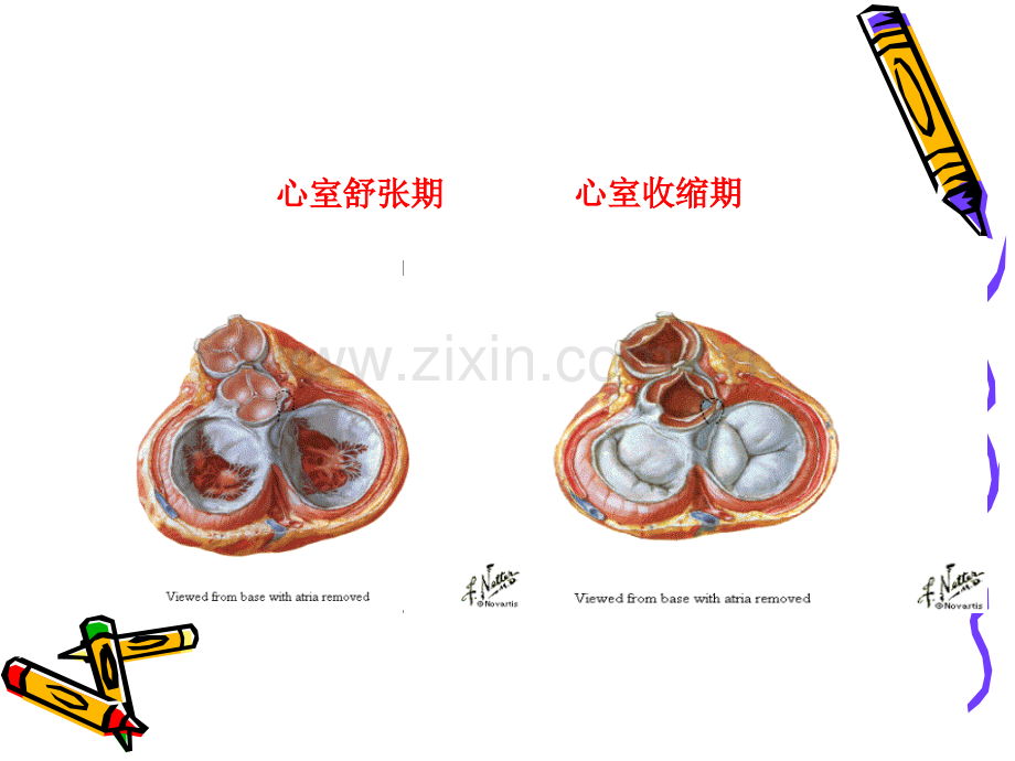 主动脉狭窄护理.pptx_第2页