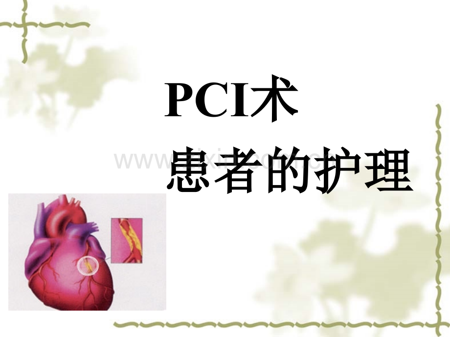 PTCA术患者护理简述.pptx_第1页