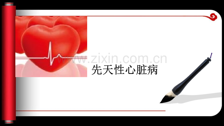 先天性心脏病l.pptx_第1页