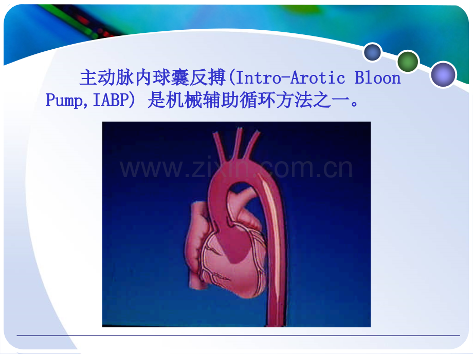 主动脉球囊反搏iabp的应用和护理课件.pptx_第2页