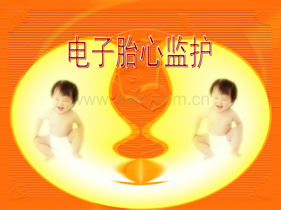 促宫颈成熟缩宫素应用及胎心监护分解.pptx_第1页