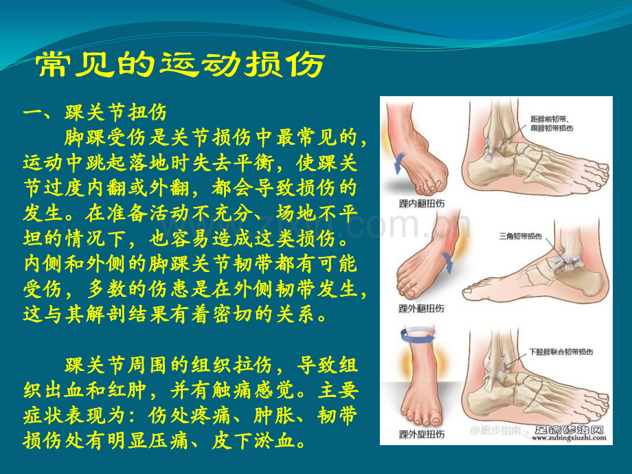 hw常见损伤的应急处理与急救解析.pptx_第2页