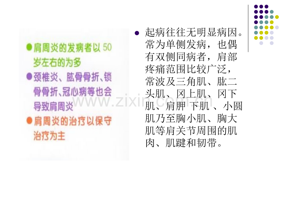 以肩关节部疼痛.pptx_第2页