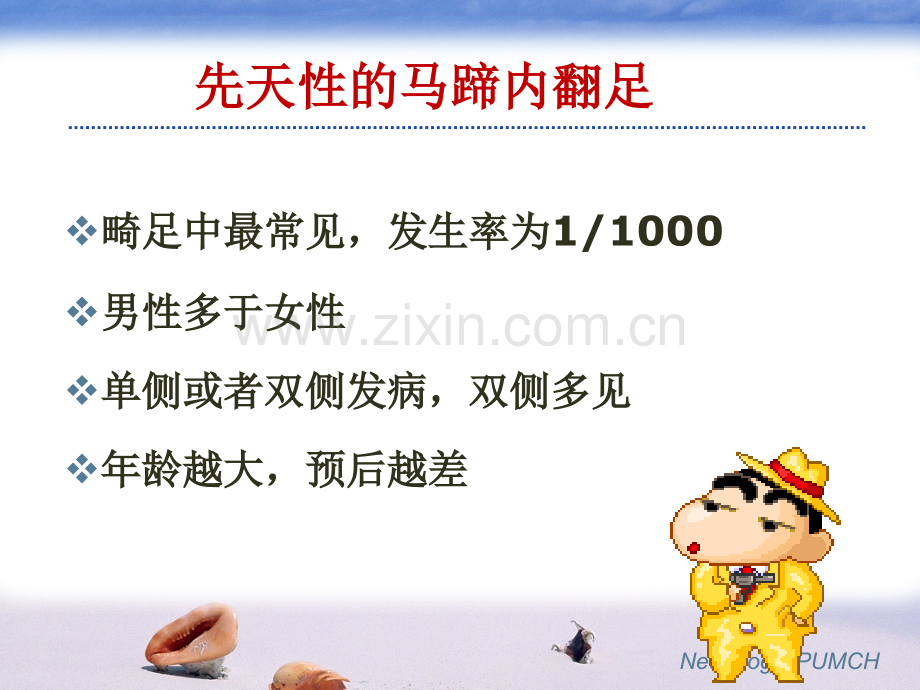 先天性马蹄足.pptx_第2页
