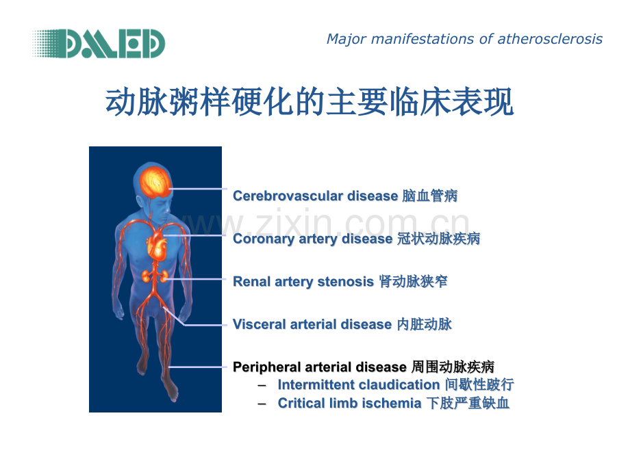 ABI踝臂指数检查.pptx_第2页