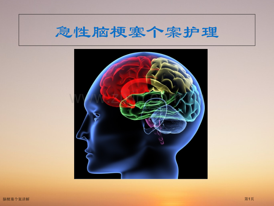 脑梗塞个案讲解.pptx_第1页