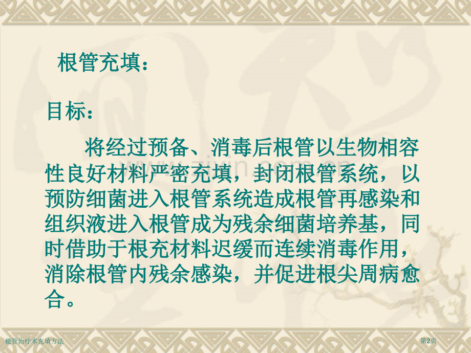 根管治疗术充填方法.pptx_第2页