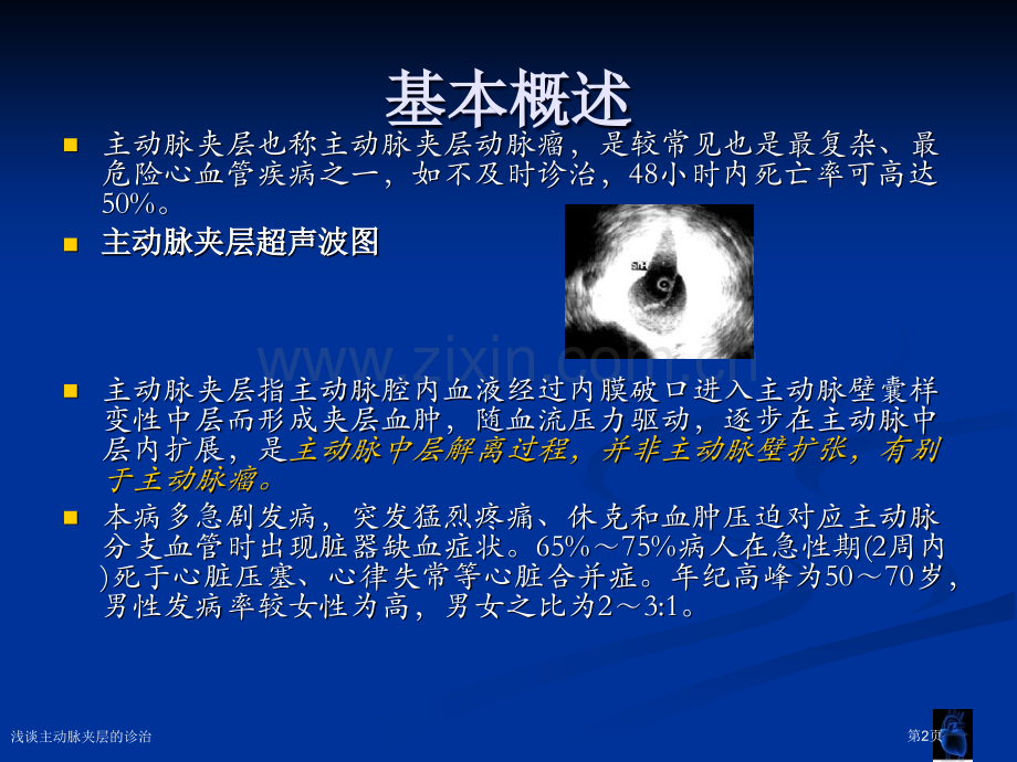 浅谈主动脉夹层的诊治专家讲座.pptx_第2页