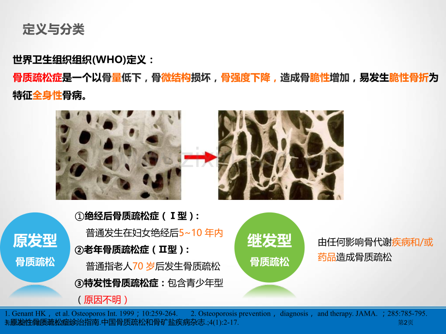 骨质疏松压缩性骨折的治疗.pptx_第2页
