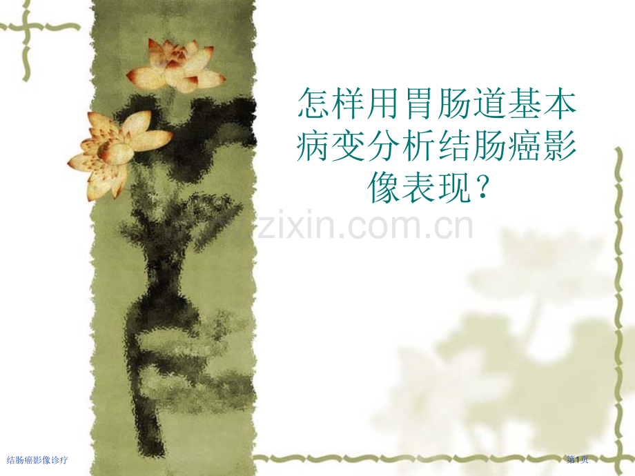 结肠癌影像诊疗.pptx_第1页