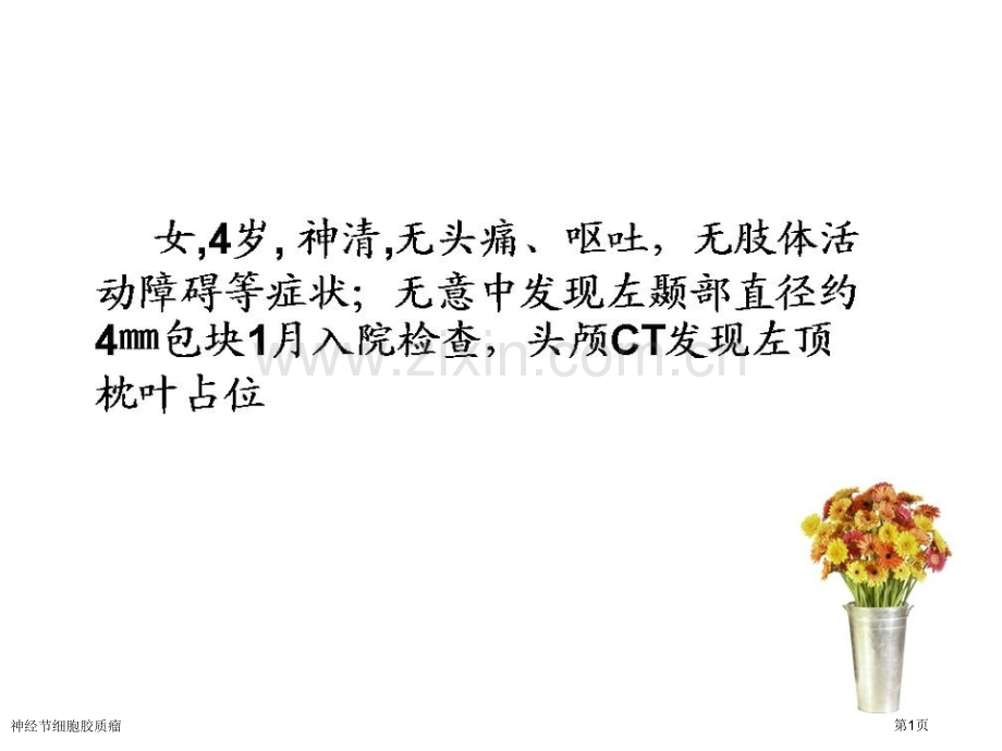 神经节细胞胶质瘤专家讲座.pptx_第1页