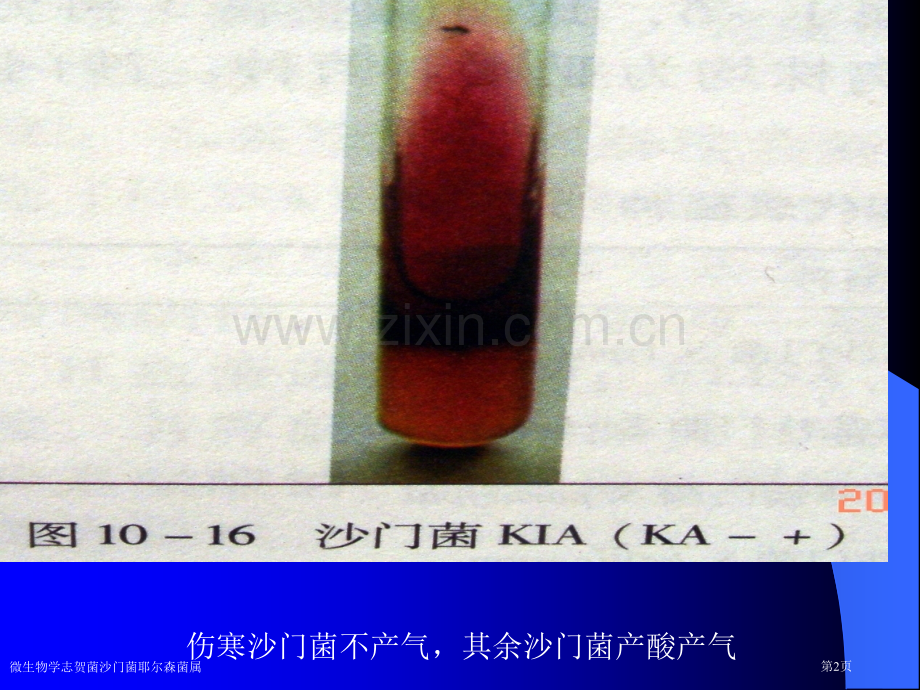 微生物学志贺菌沙门菌耶尔森菌属专家讲座.pptx_第2页