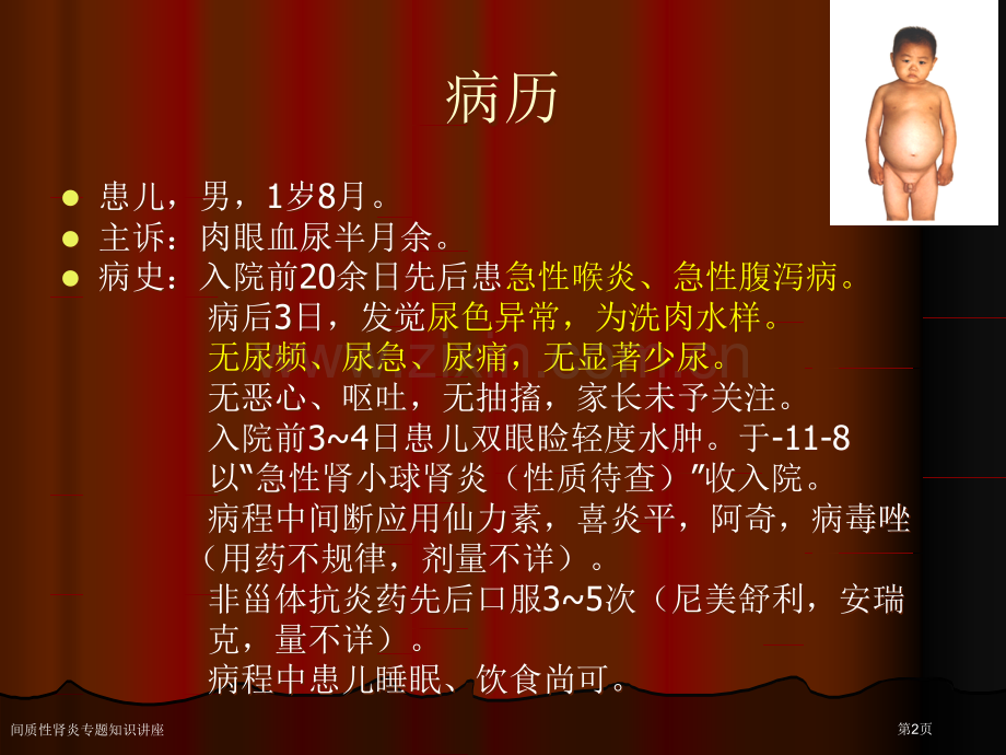间质性肾炎专题知识讲座.pptx_第2页