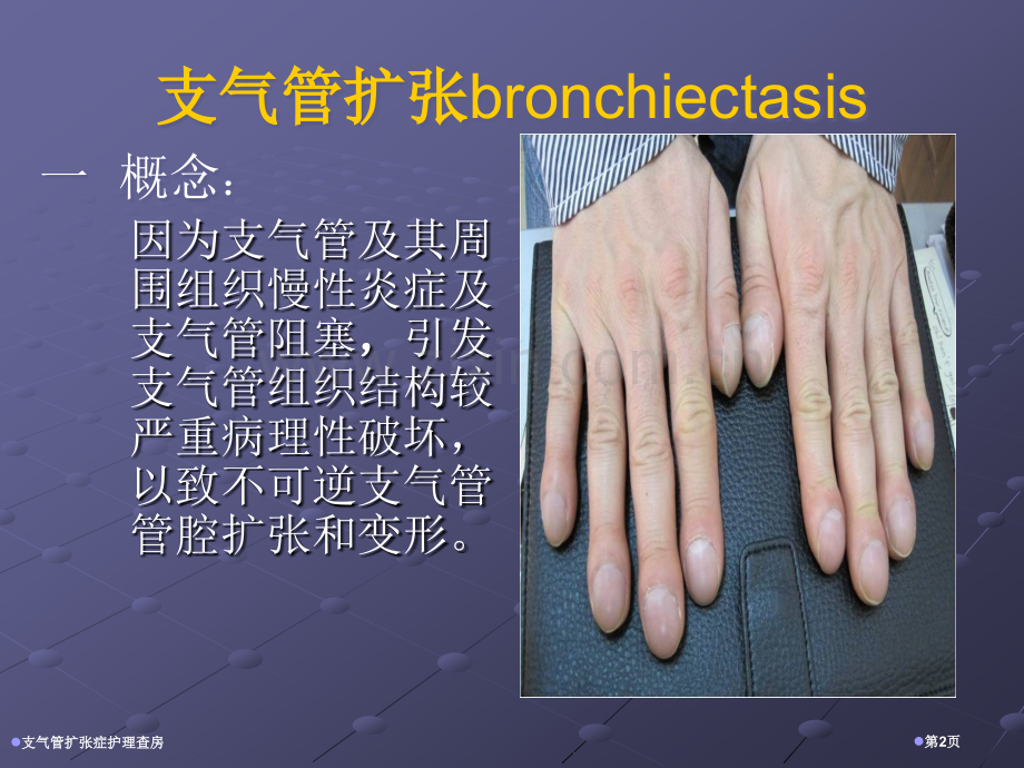 支气管扩张症护理查房专家讲座.pptx_第2页