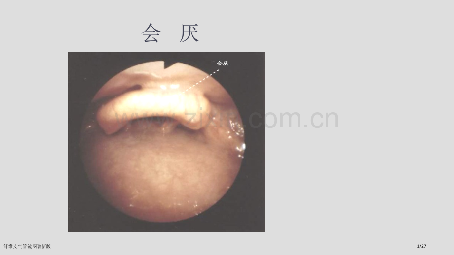 纤维支气管镜图谱新版.pptx_第1页
