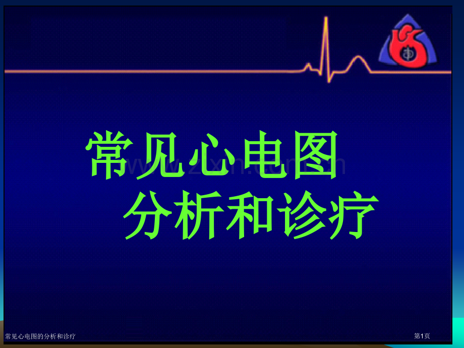 常见心电图的分析和诊疗.pptx_第1页