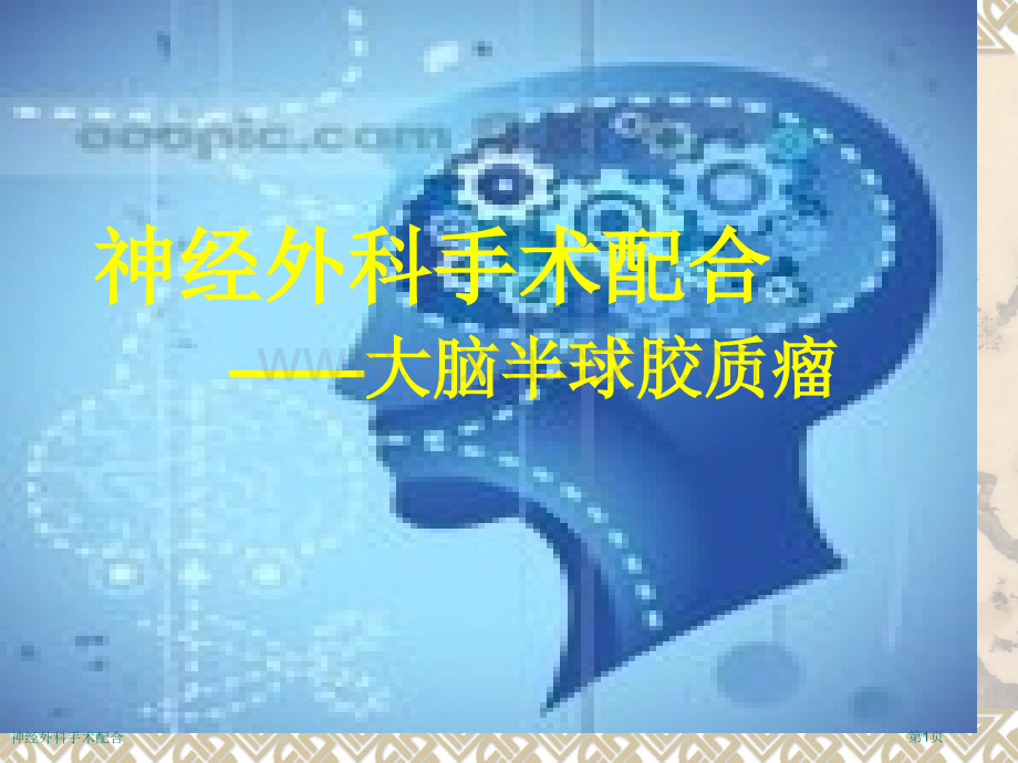 神经外科手术配合.pptx_第1页