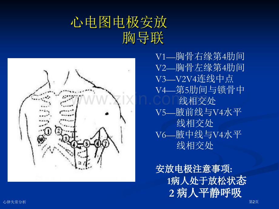 心律失常分析专家讲座.pptx_第2页