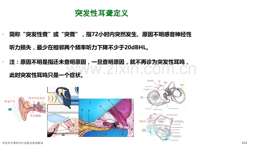 突发性耳聋的诊疗进展及指南解读.pptx_第2页