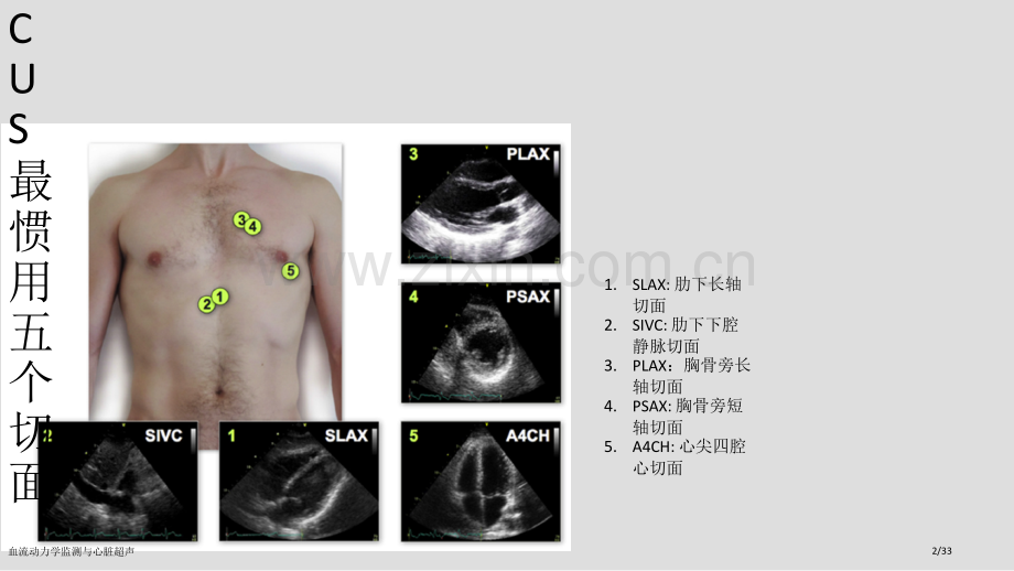 血流动力学监测与心脏超声.pptx_第2页