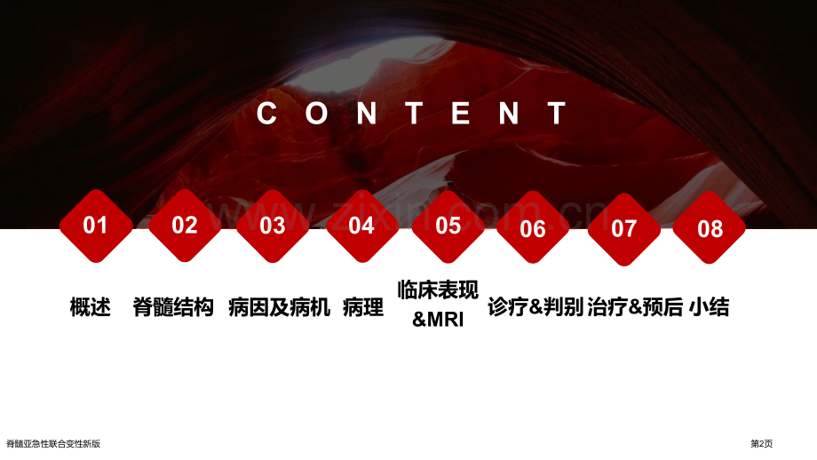 脊髓亚急性联合变性新版.pptx_第2页