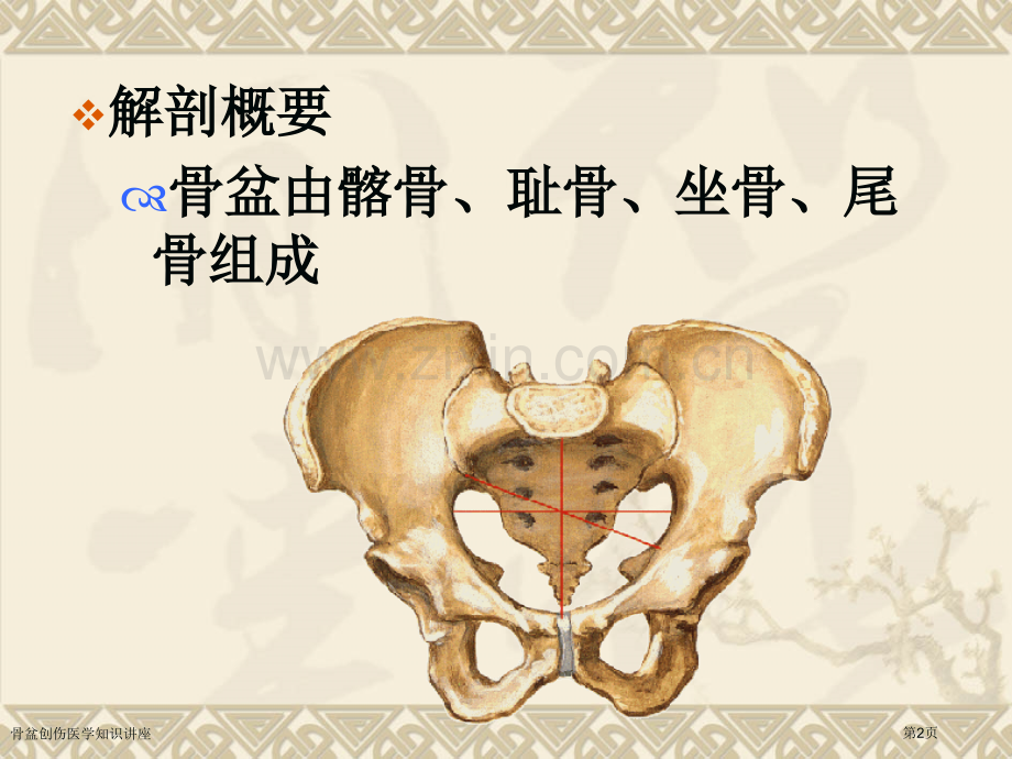 骨盆创伤医学知识讲座专家讲座.pptx_第2页