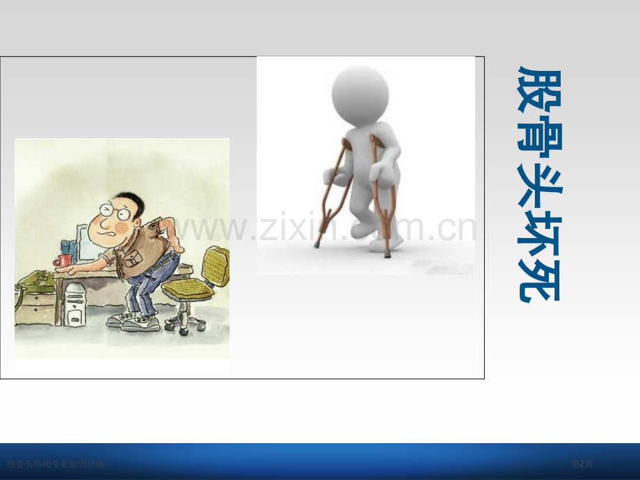 股骨头坏死专业知识讲座.pptx_第2页