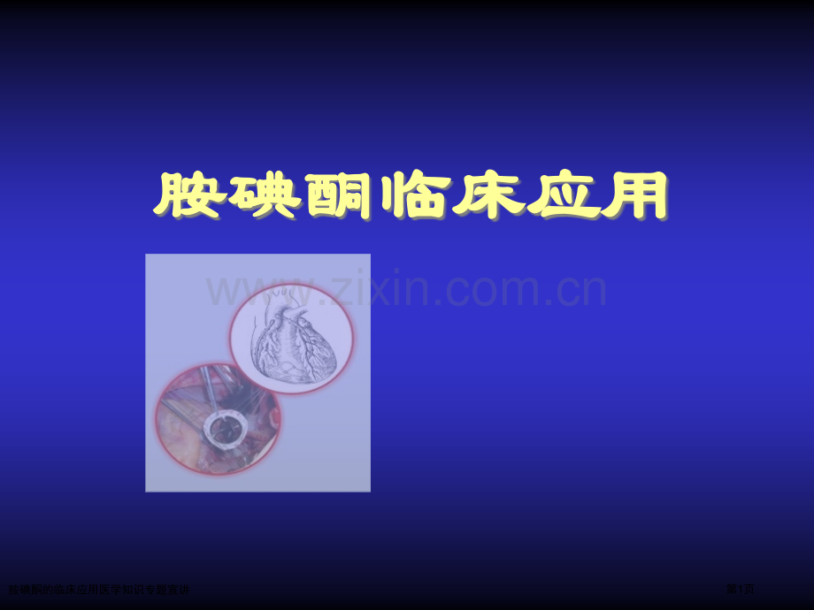 胺碘酮的临床应用医学知识专题宣讲专家讲座.pptx_第1页