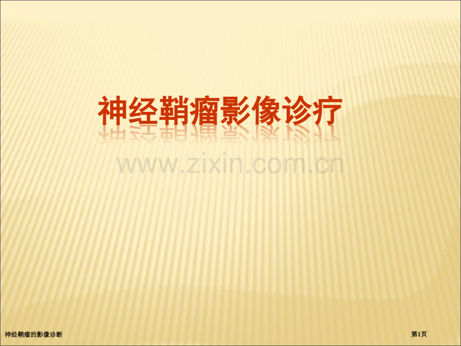 神经鞘瘤的影像诊断.pptx_第1页