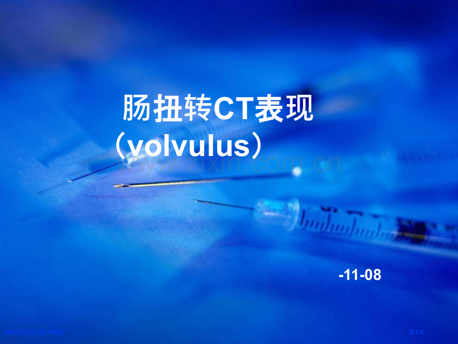 肠扭转总论及CT表现.pptx_第1页